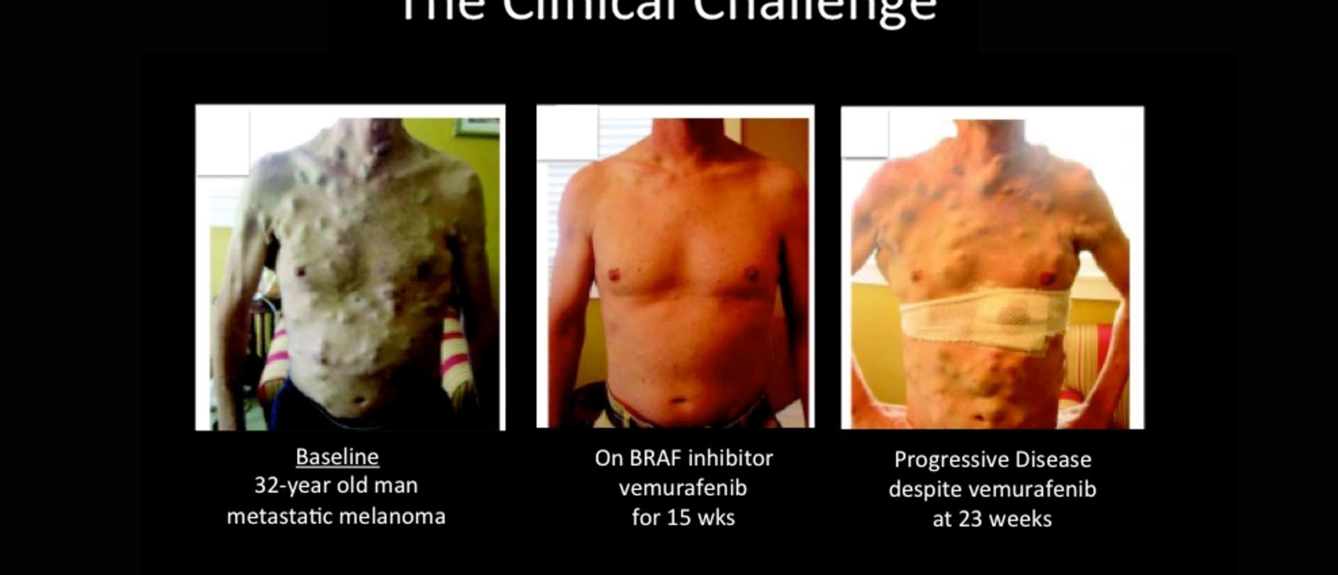 revised_clinical_challenge.jpg